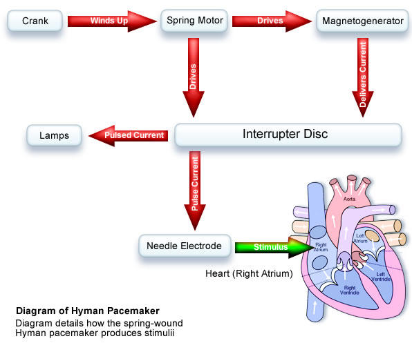 Basic functional mechanisms to the Hyman pacemaker.