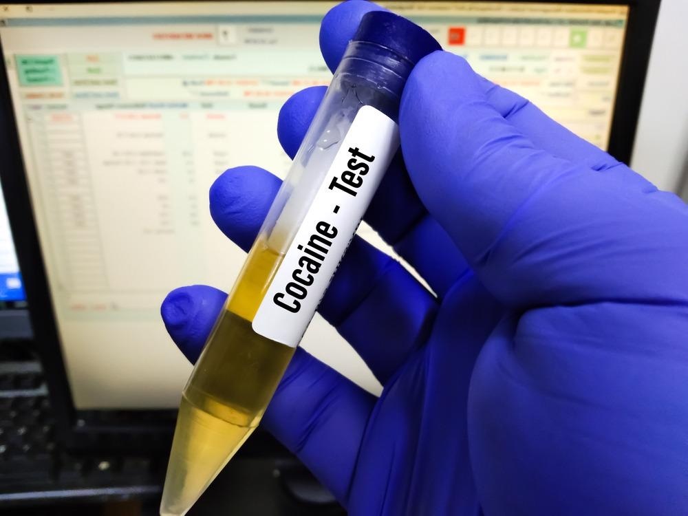 Revolutionizing Intoxication Detection with Smartphones, cannabis, cocaine, drug testing, illegal drugs