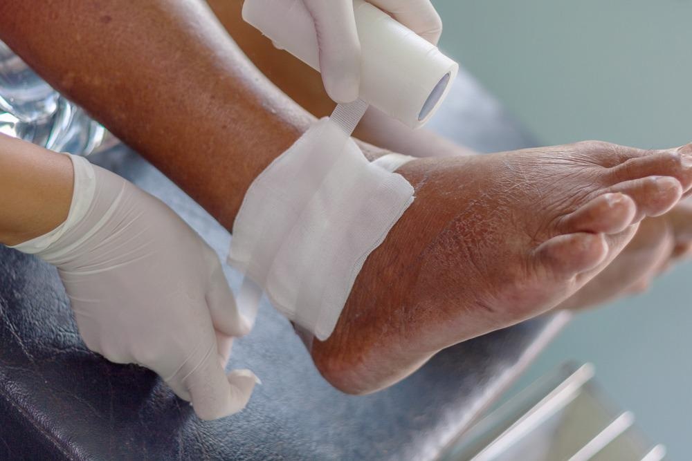 chronic wounds