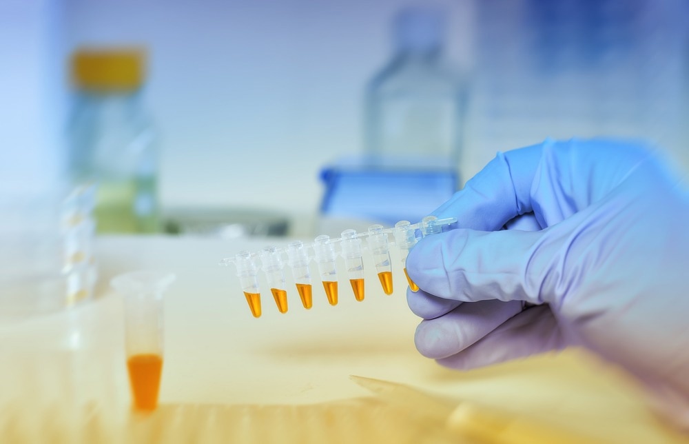 Scientific background in blue and orange, space for your text. Hand in blue glove holding samples for DNA amplification with orange reaction mictures.