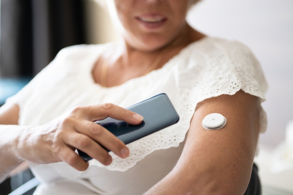 Woman Testing Glucose Level With Continuous Glucose Monitor On Mobile Phone