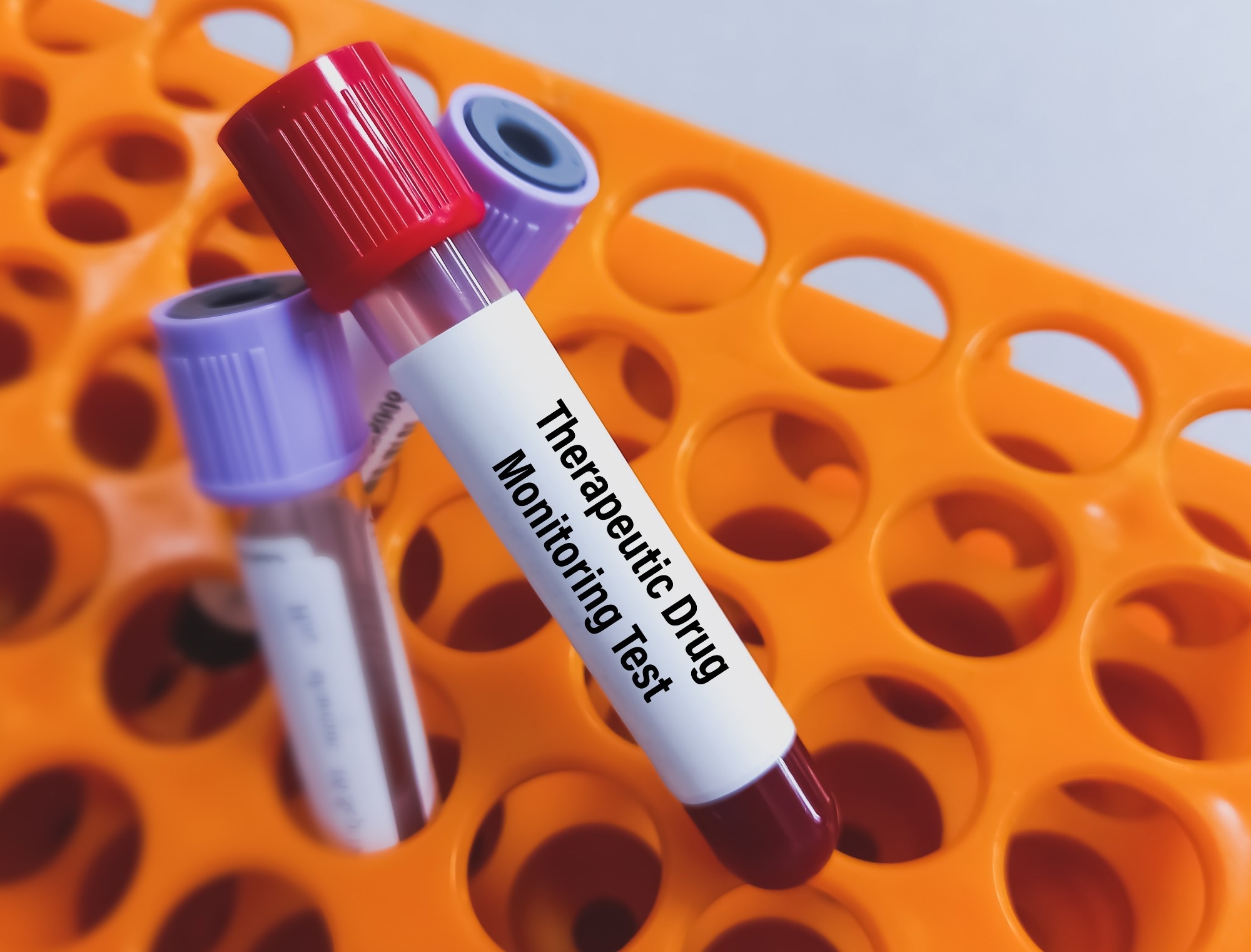 Biosensors and their Role in Antibiotics Monitoring