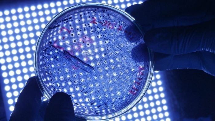 Enhanced Bacteria Detection with Plasma-Treated Sensors