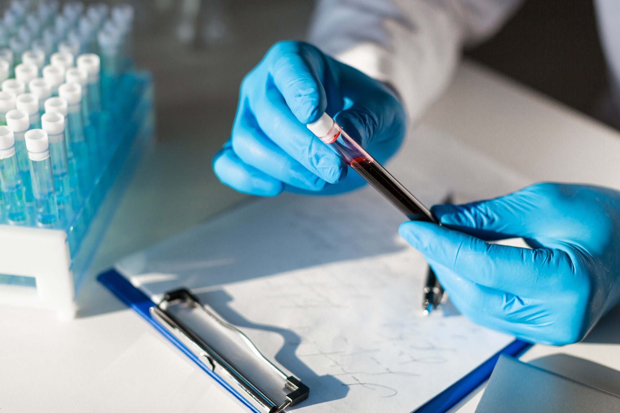 Integrated Microfluidic Sensors: Breakthroughs in Lab-on-a-Chip Technologies for Point-of-Care Diagnostics