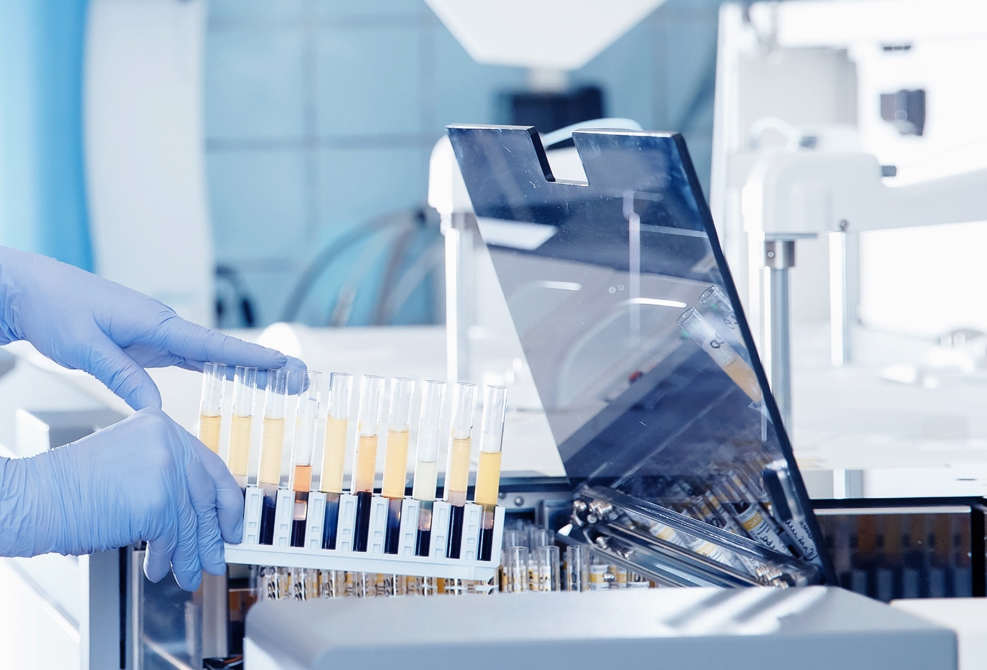 Scientist downloads blood samples to test dna in laboratory.