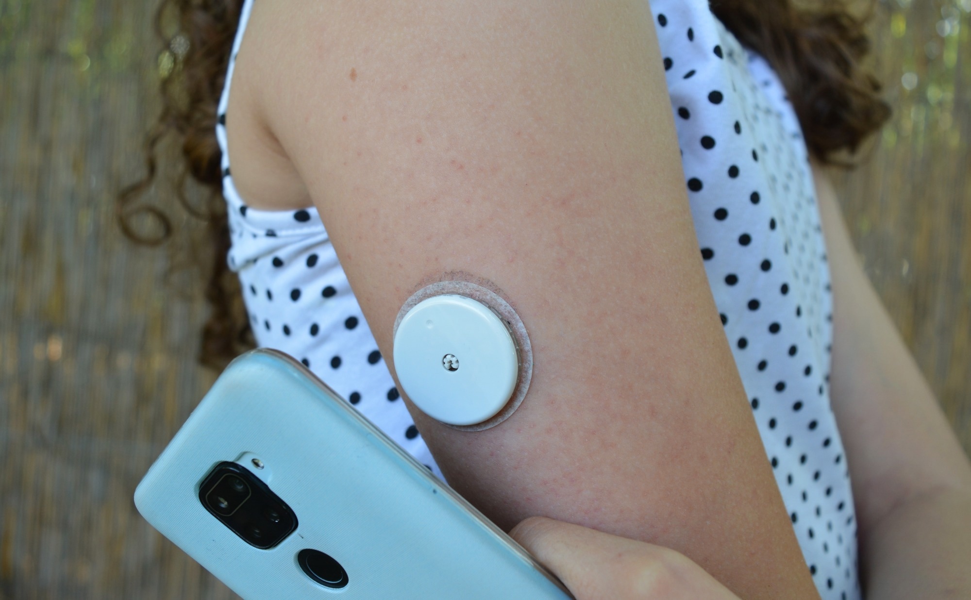 Girl use application on mobile phone to read sensor for continuous glucose monitoring on arm.