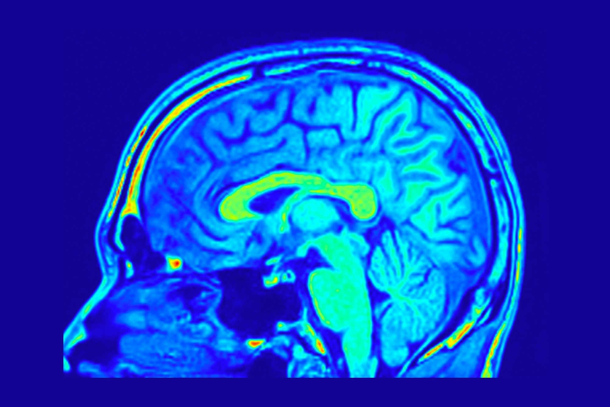 Sagital colorful Slice of Human Brain MRI.  Image shows the human brain with this sagital slice captured by a 1.5 Tesla MRI machine.