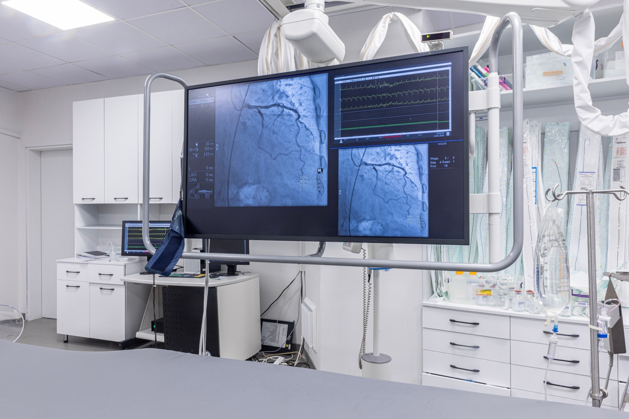 A hospital room with a monitor displaying a patient