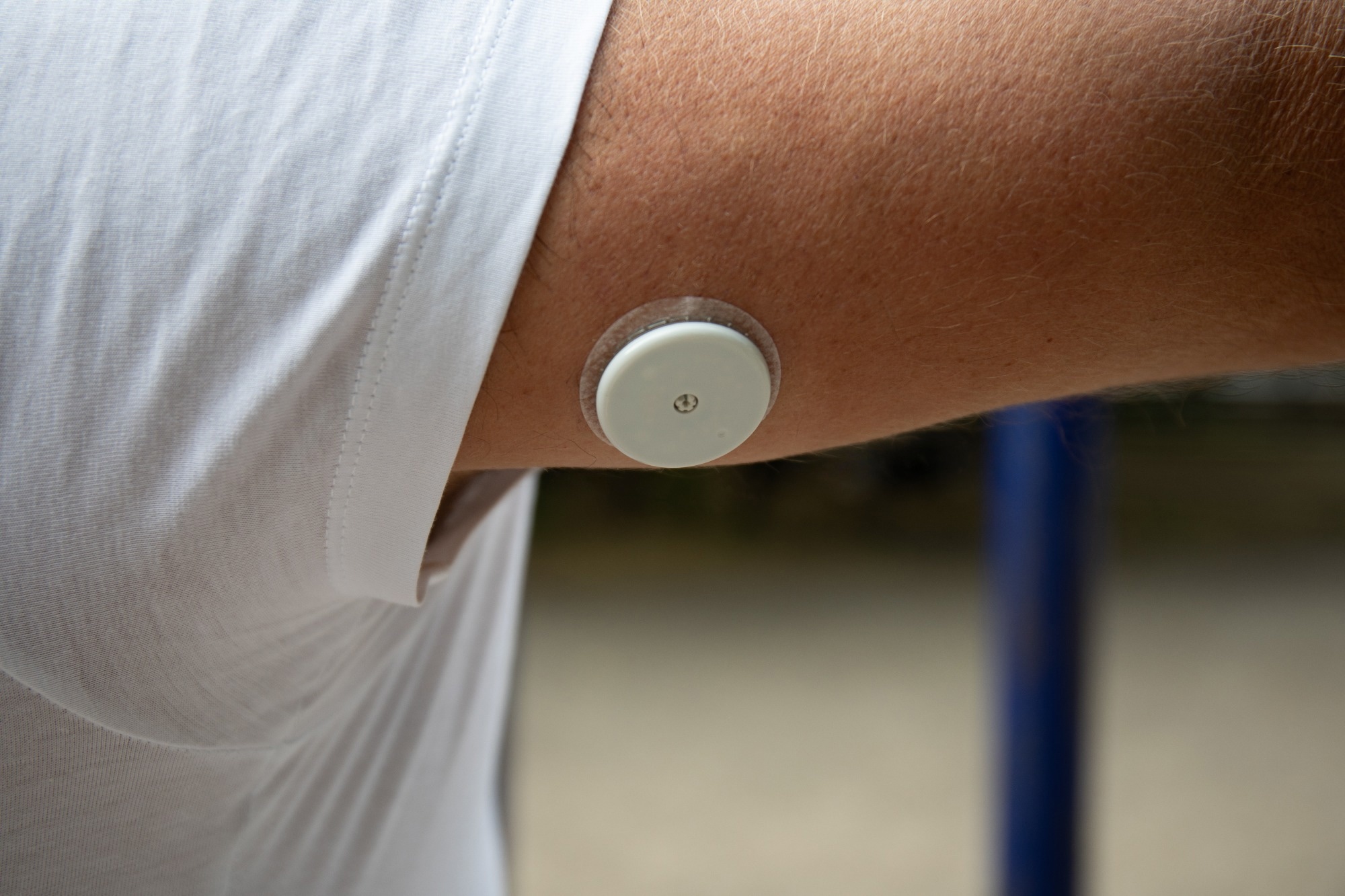 Wearable Biosensors