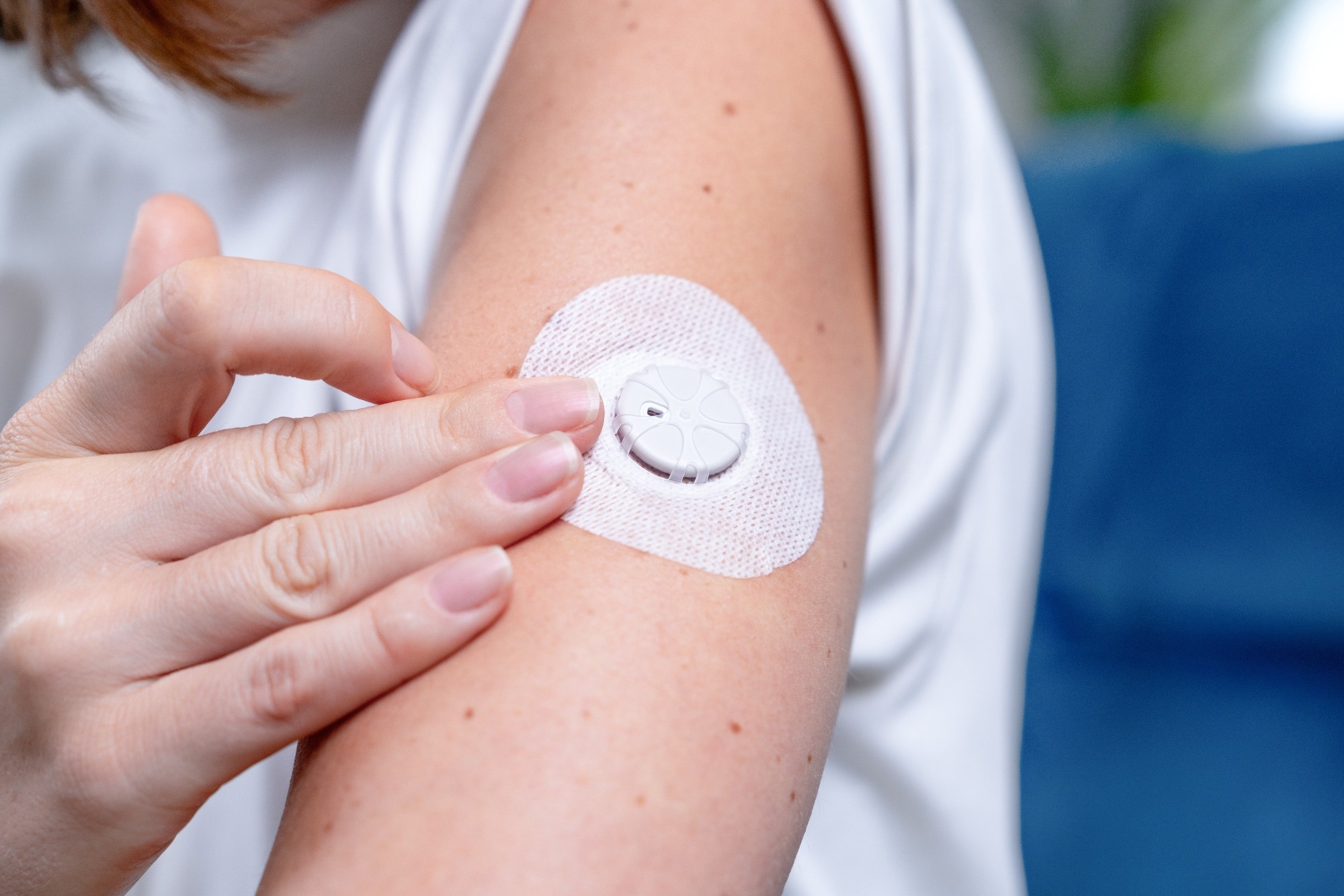 CGM Biosensor