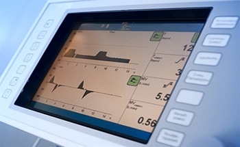 What are the Pros and Cons of Mass Air Flow Sensors?