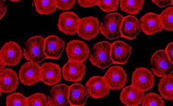 Biomedical Applications: Can CMOS Replace sCMOS Sensors?