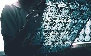 The Future of Using Wearables and Smartphones to Detect Early Alzheimer's Disease