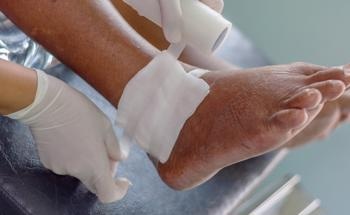 Utilizing Sensors to Aid Chronic Wound Healing
