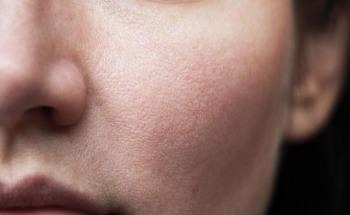 Wearable Colorimetric Sensors to Determine Skin Surface pH