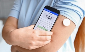 Transforming Diabetes Care with Continuous Glucose Monitoring