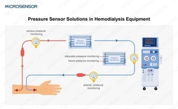 Biocompatible Pressure Sensors for Hemodialysis Equipment