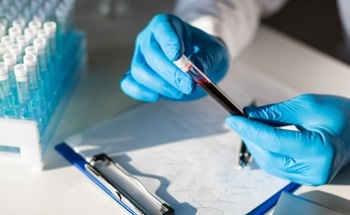Microfluidic Sensors for Point-of-Care Diagnostics