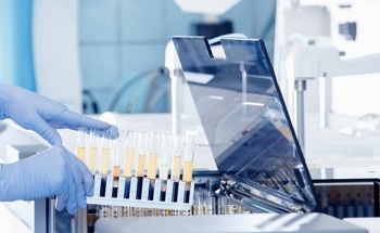 Will SPR Biosensors Transform Medical Diagnostics?