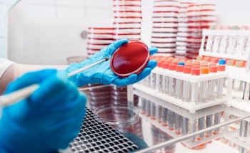 Detecting Pathogenic Bacteria at Micro Scale: Trends in Rapid Microfluidic Biosensing