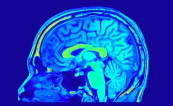 How Cerca Magnetics Is Using Quantum Sensing to Improve Epilepsy Imaging