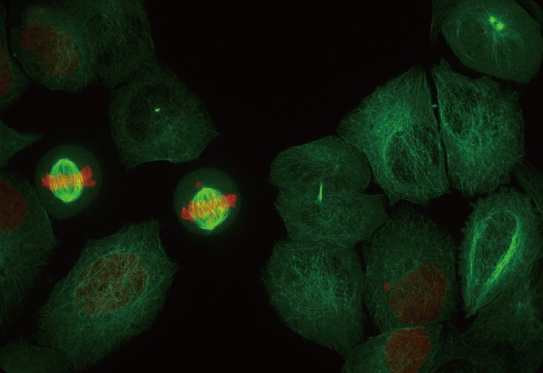 Super resolution images from ORCA-Quest - qCMOS camera / 4.6 μm pixel size