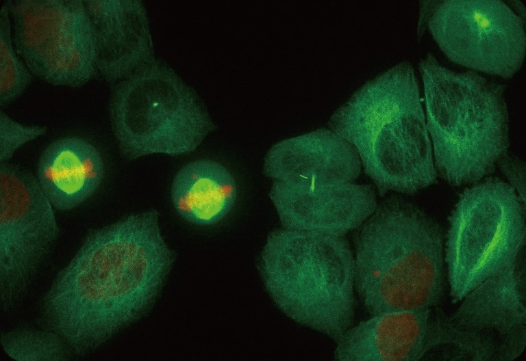 Super resolution images from ORCA-Fusion - Gen III sCMOS camera / 6.5 μm pixel size
