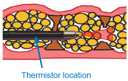 Surgical Temperature Sensors from Amphenol