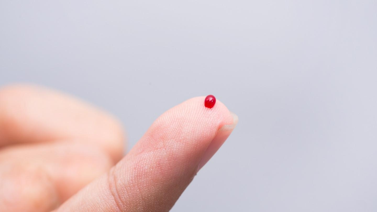 Novel Microchip Sensor Measures Stress Hormones in Real-Time.