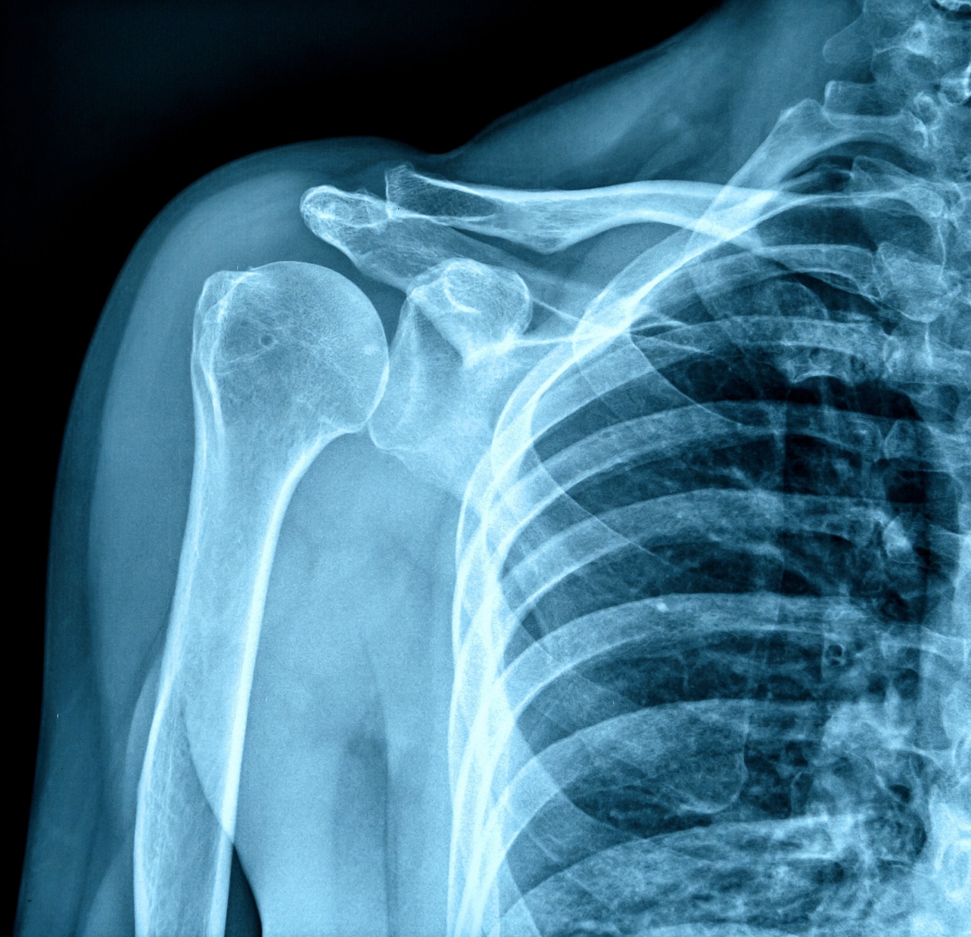 Flexible Organic Semiconductors Revolutionize X-Ray Detection