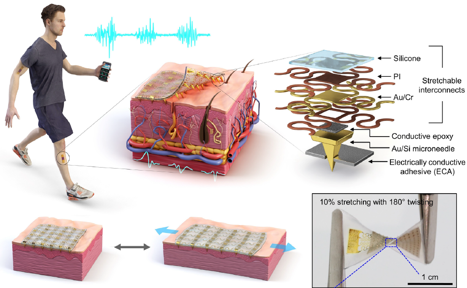 Wearable Electrophysiological Sensor Provides Precise EMG Measurements