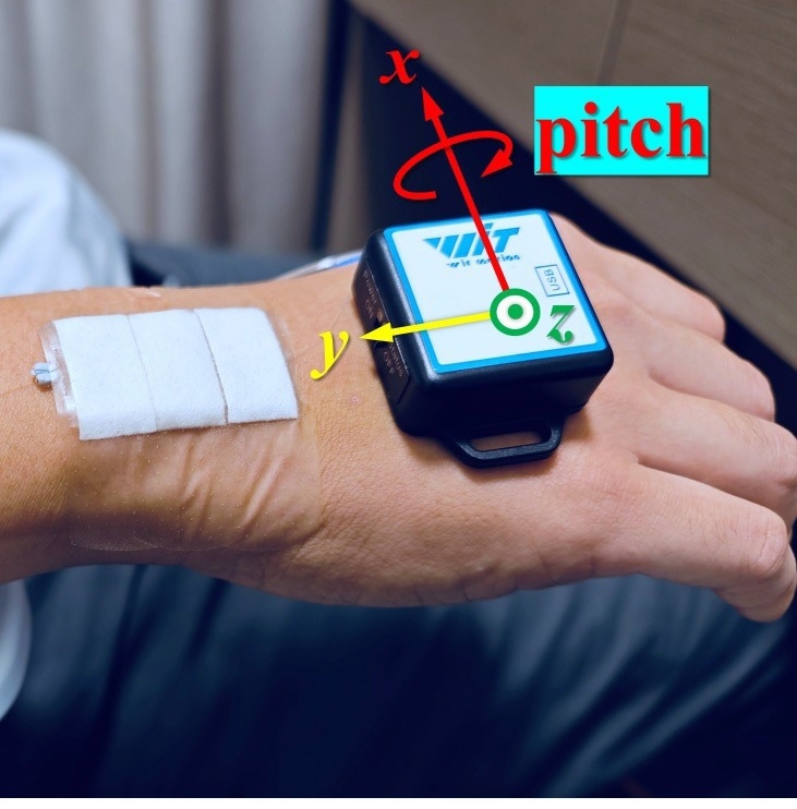 Enhancing Rehabilitation Progression With Wearable Sensor Technology