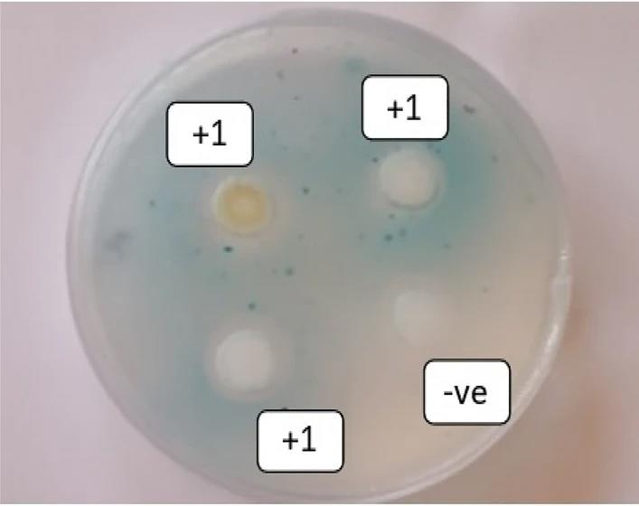 Nanomaterial Biosensors for Industrial Bacteria Detection