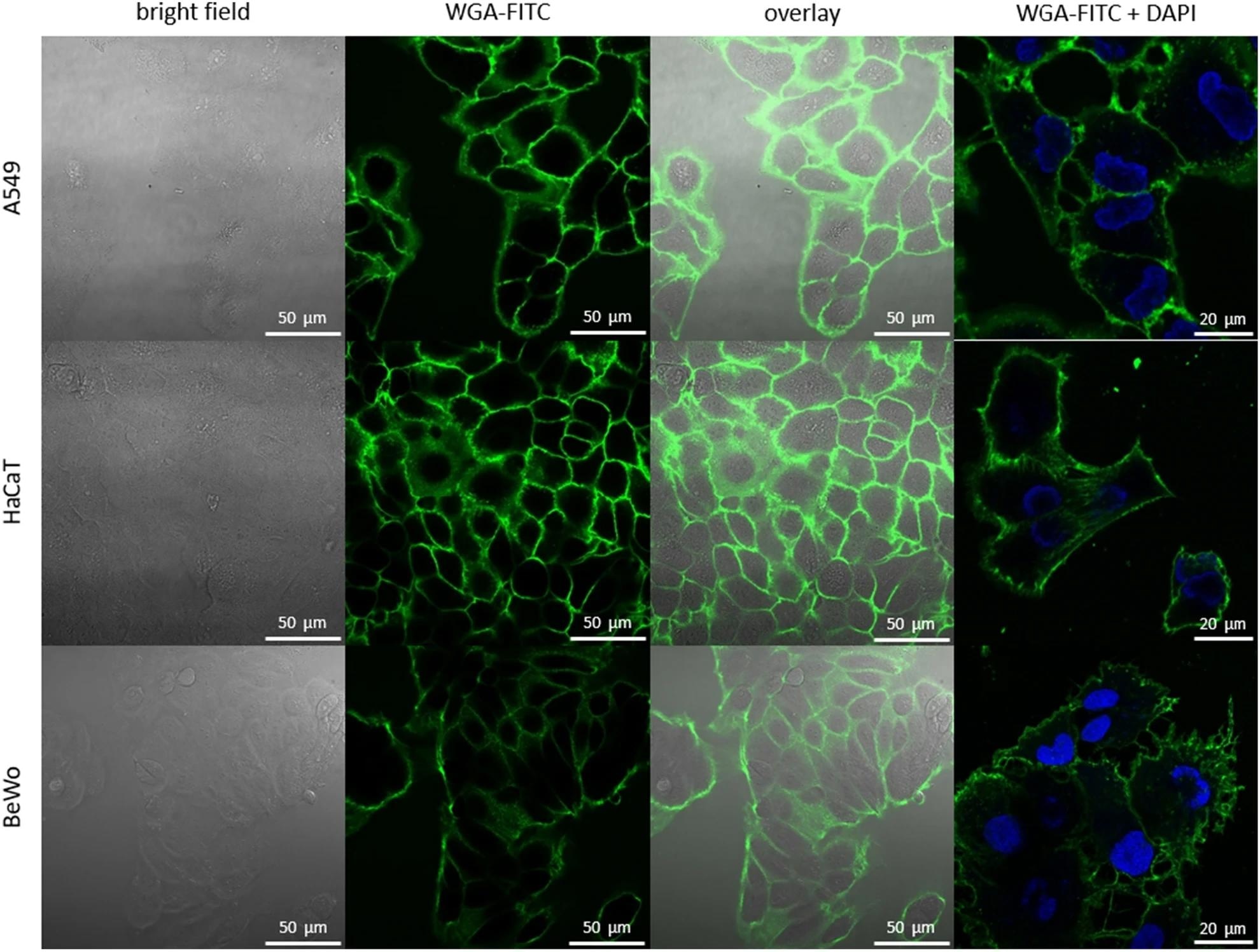 Novel pH Nanosensor for Targeted Cell Membrane Monitoring