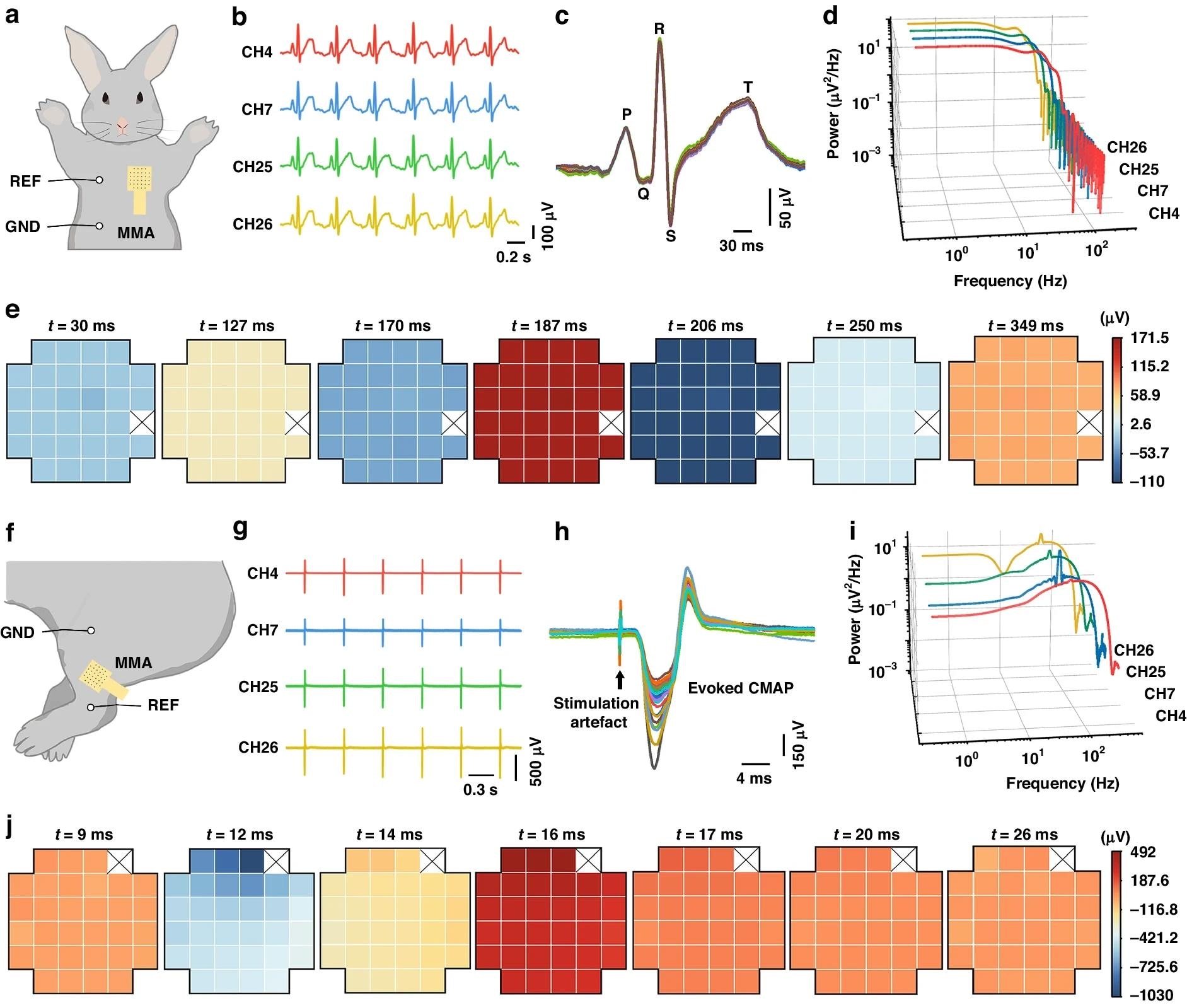 Microneedle Patches Boost Electrophysiology Accuracy