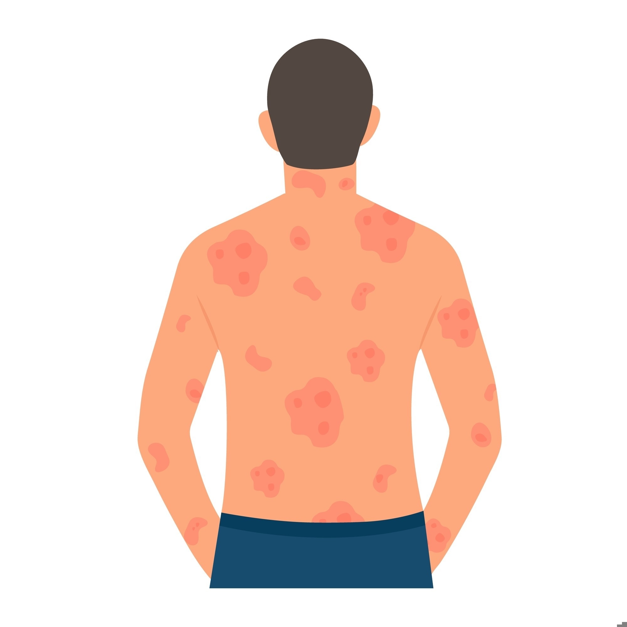 New Bioelectronic Patch Helps Treat Chronic Skin Conditions