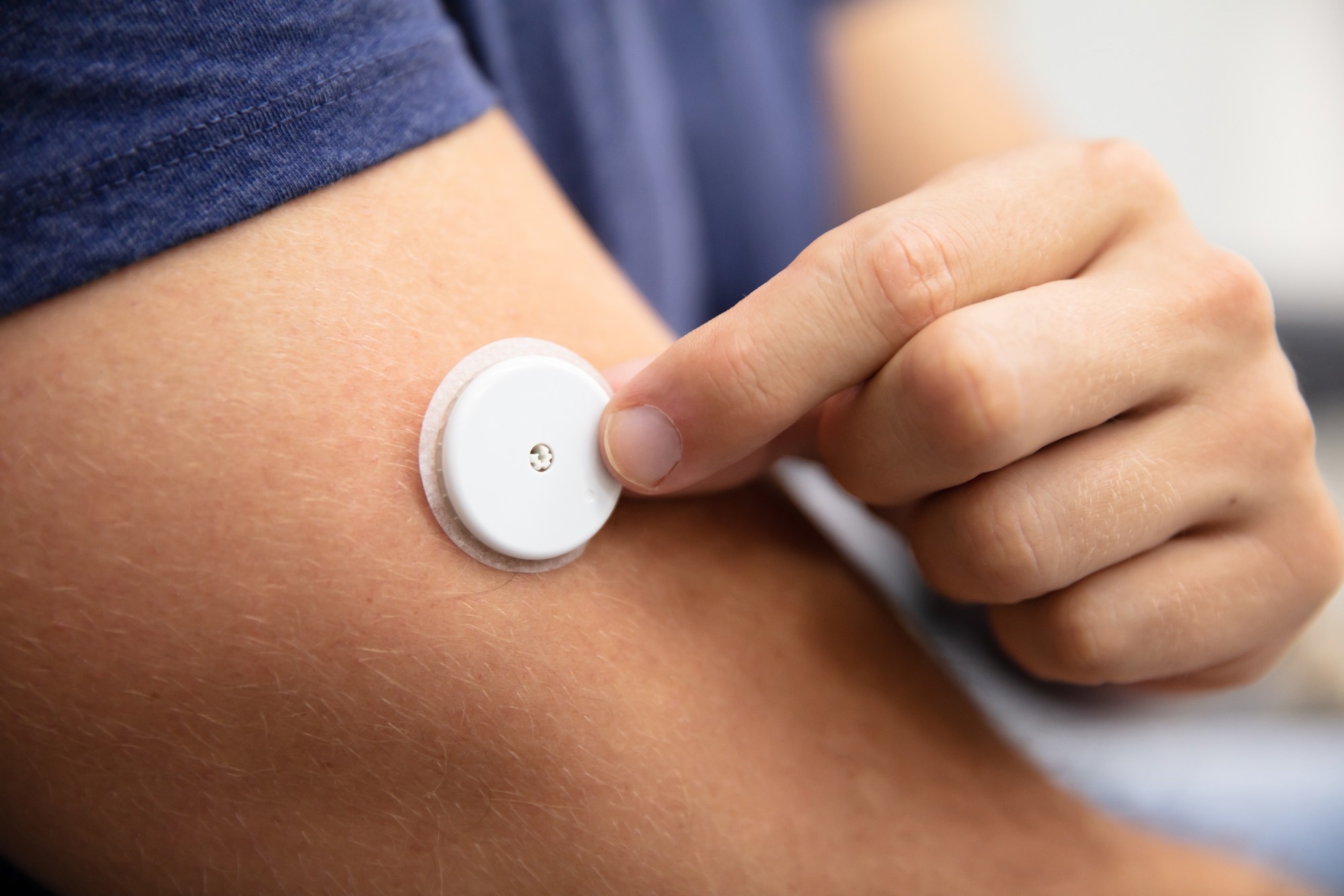 Carbon Nanofiber Sensor Revolutionizes Glucose Detection