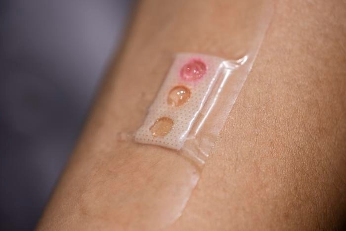 New “Band-Aid” Reads Blood Sugar Levels Through Sweat