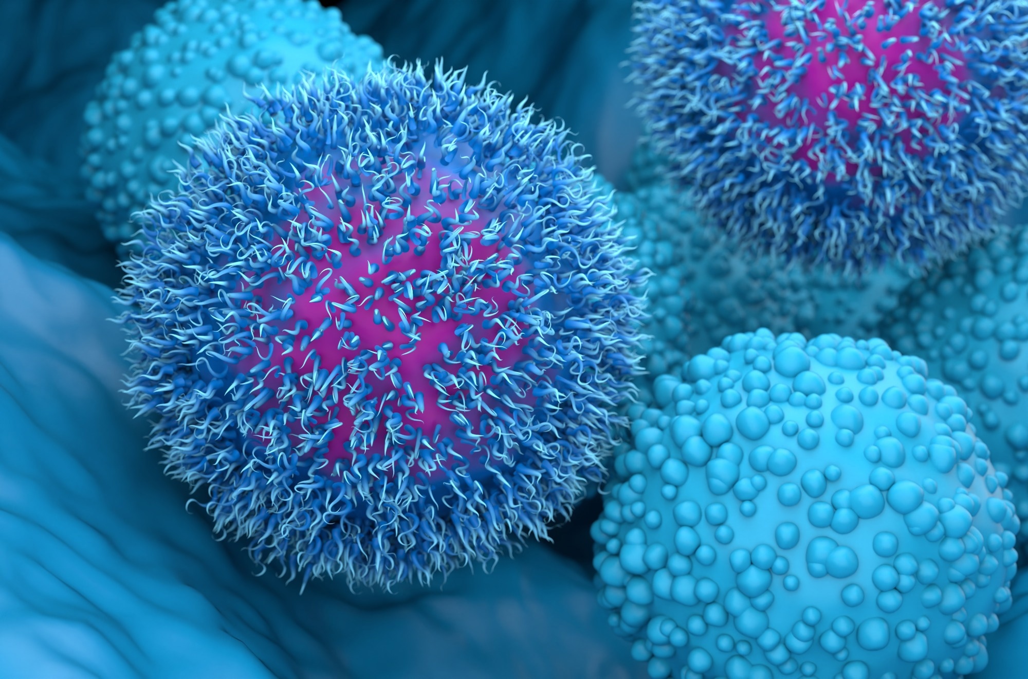 Sensitive Microfluidic Sensors Detect Pancreatic Cancer Cells