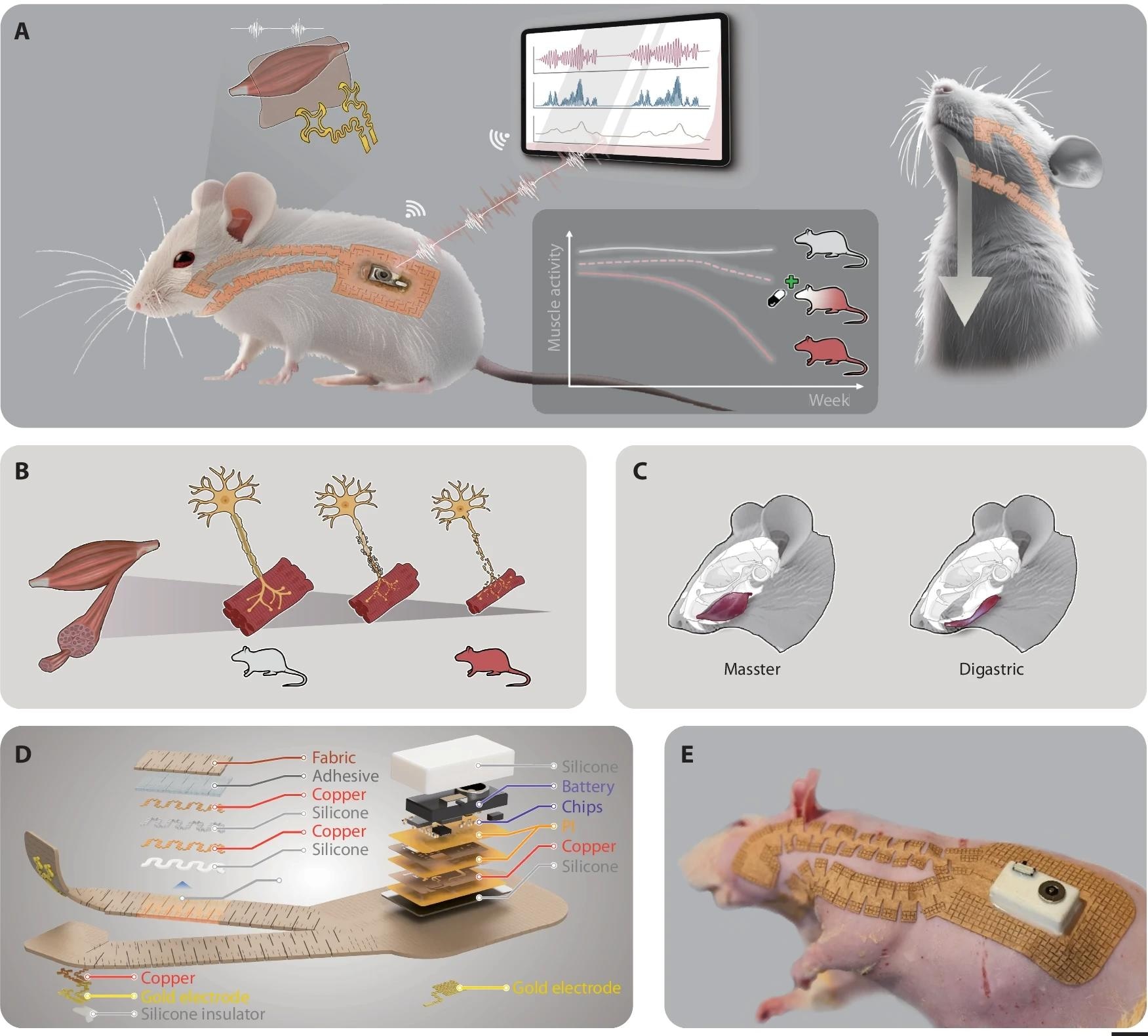 Breakthrough Wearable Tech for ALS Drug Testing