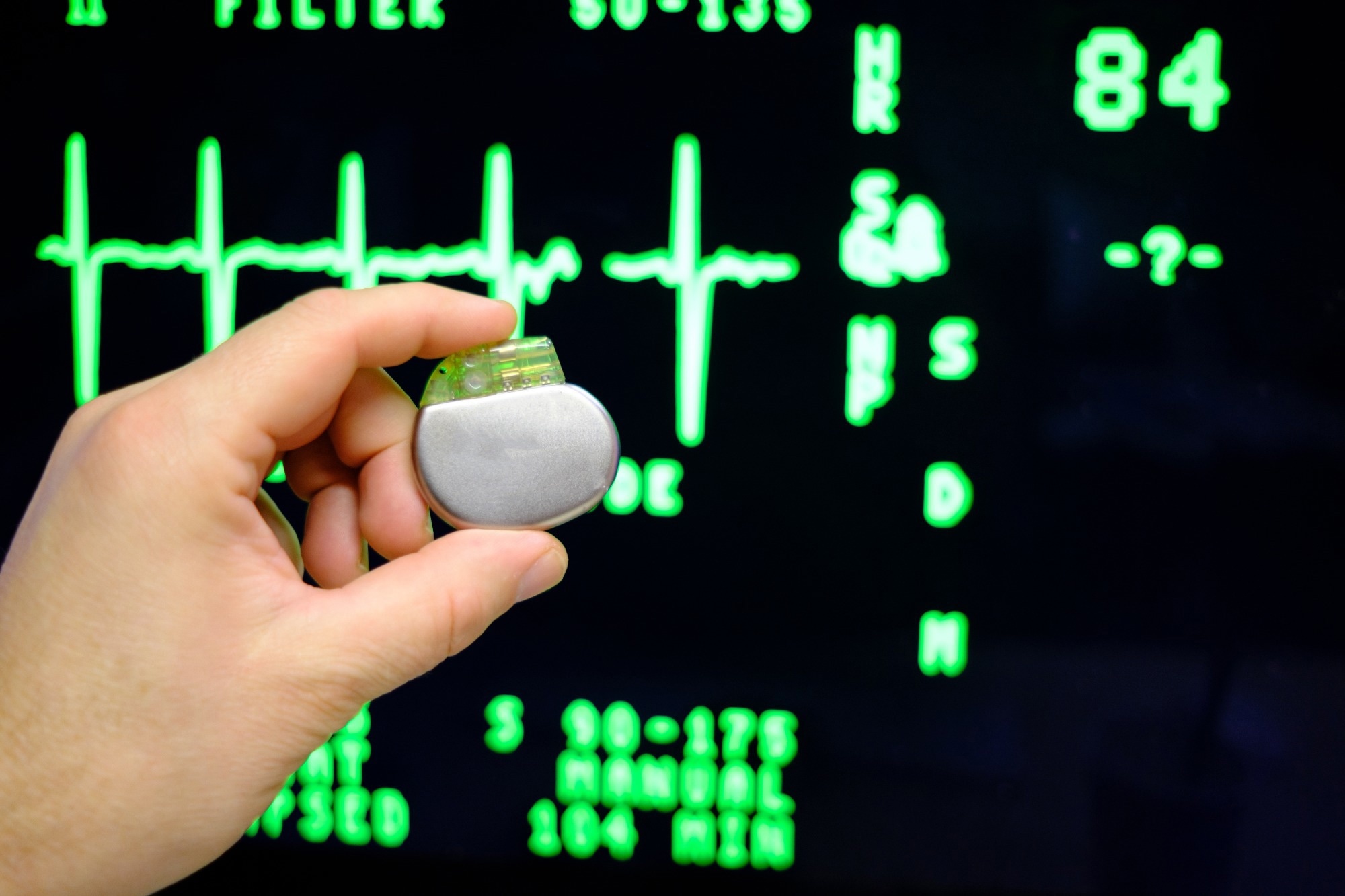 Dual-Chamber Leadless Pacemaker Enhances Cardiac Synchrony