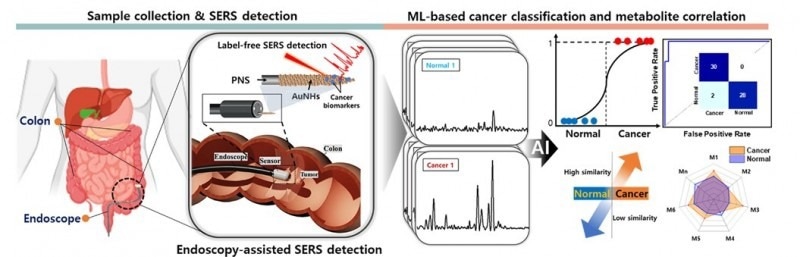Harnessing the Power of AI and Plasmonics for Early Cancer Detection