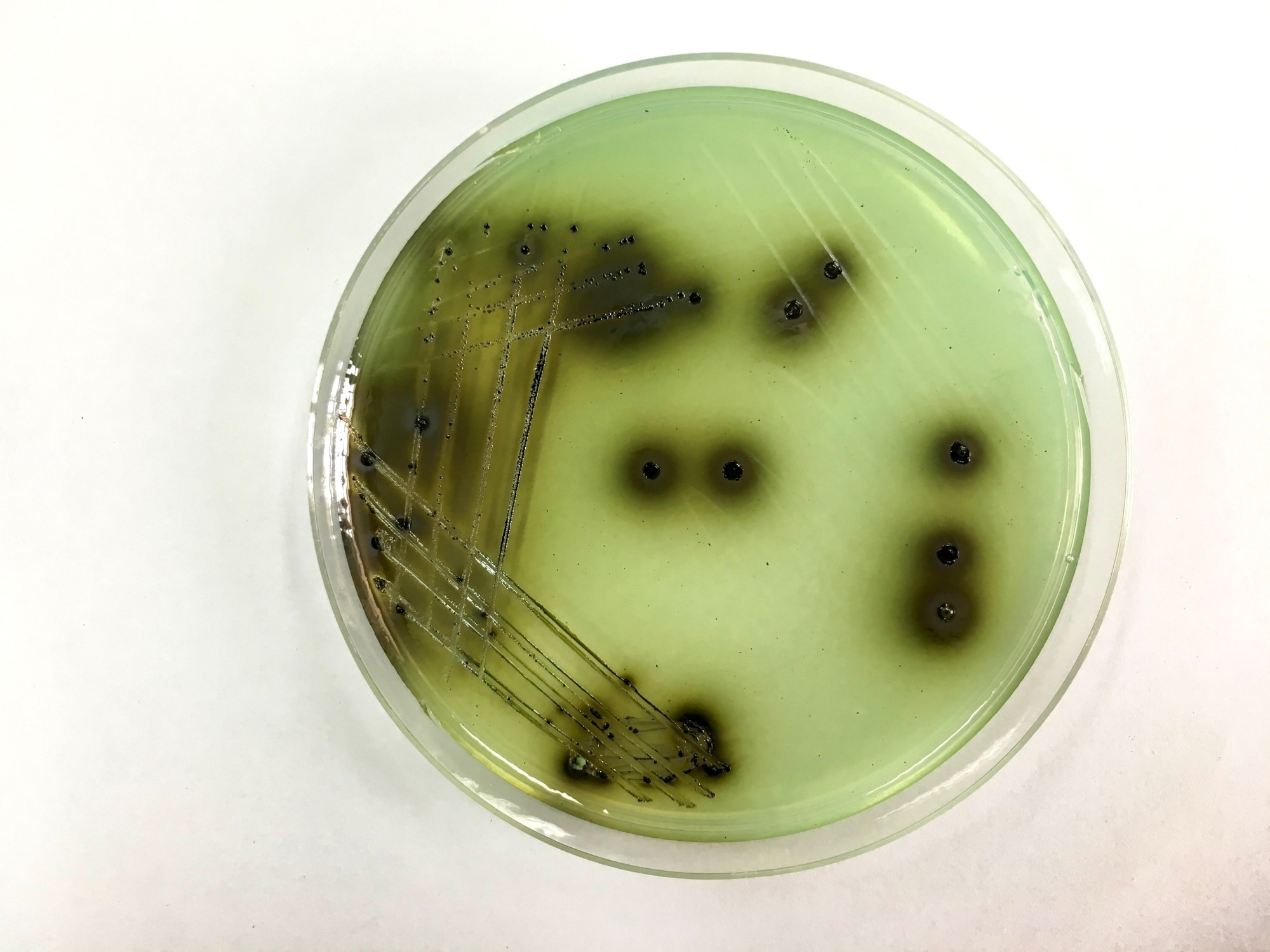Biosensor Detects Salmonella with Ultrafast Sensitivity