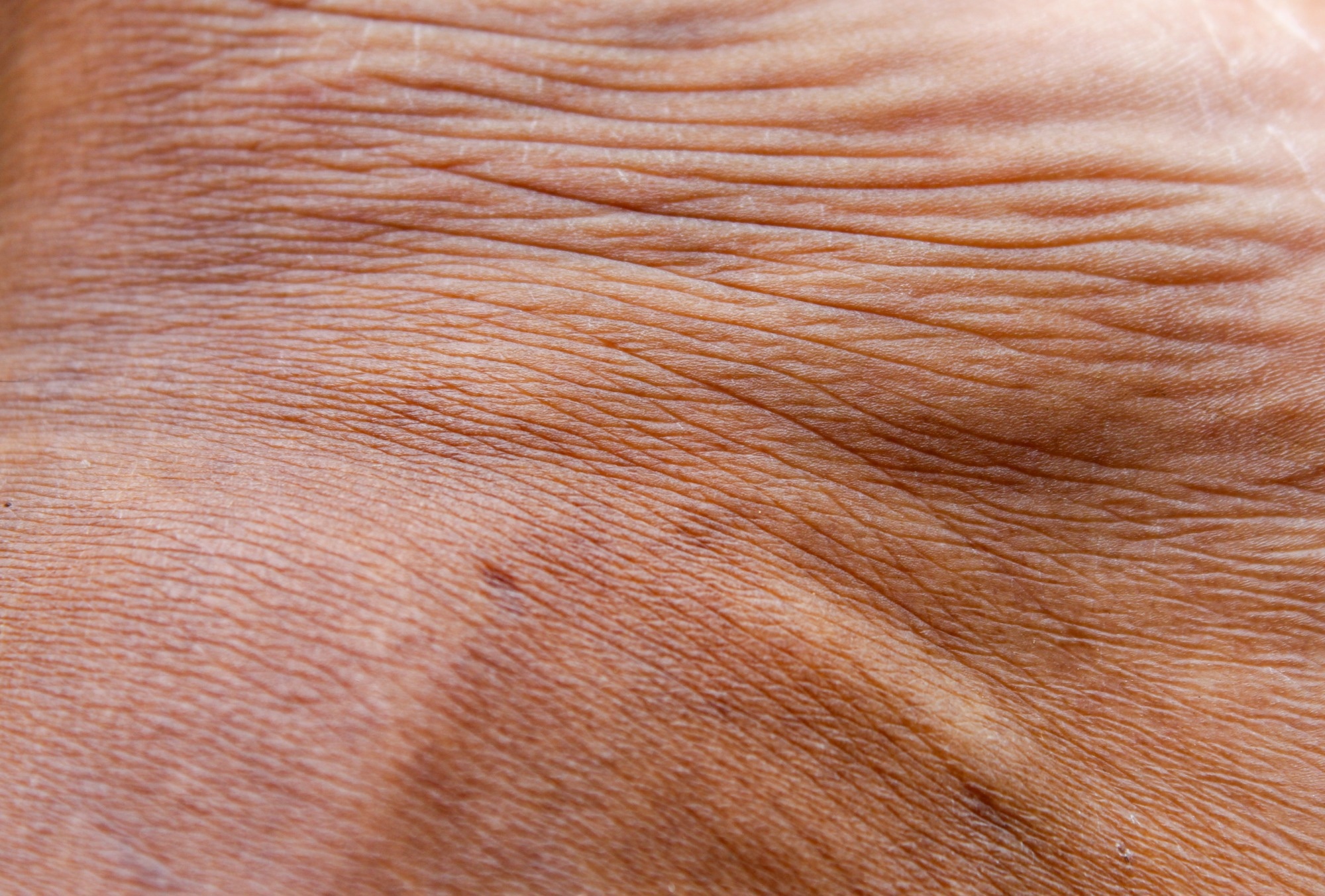 Revolutionizing On-Skin Prototyping with the SkinLink Toolkit