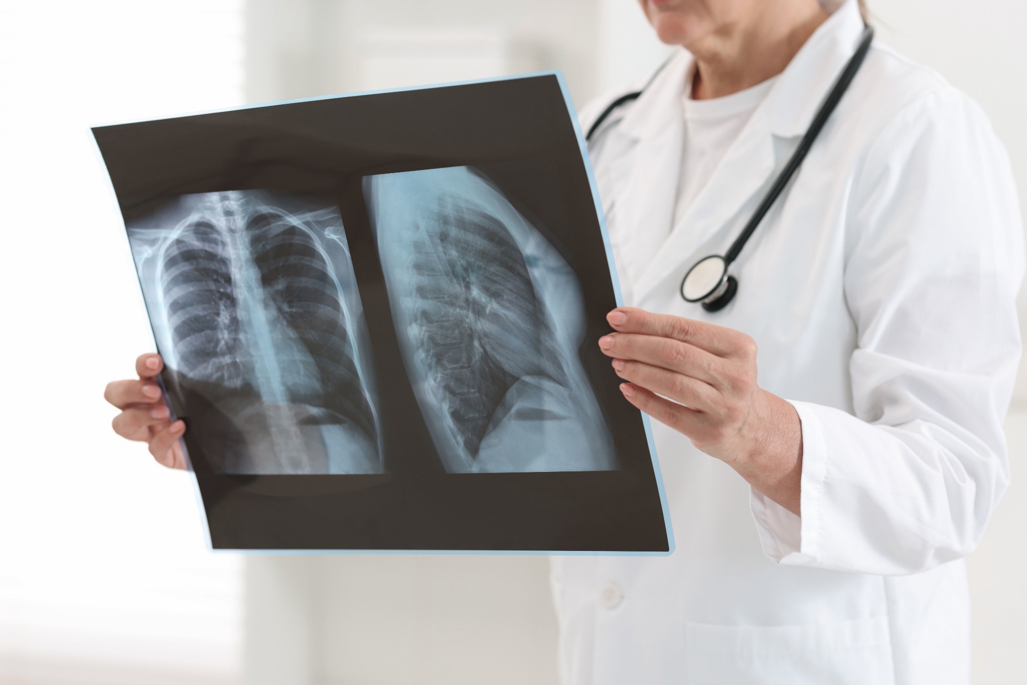 Detecting Lung Cancer with Nanoscale Breath Sensors