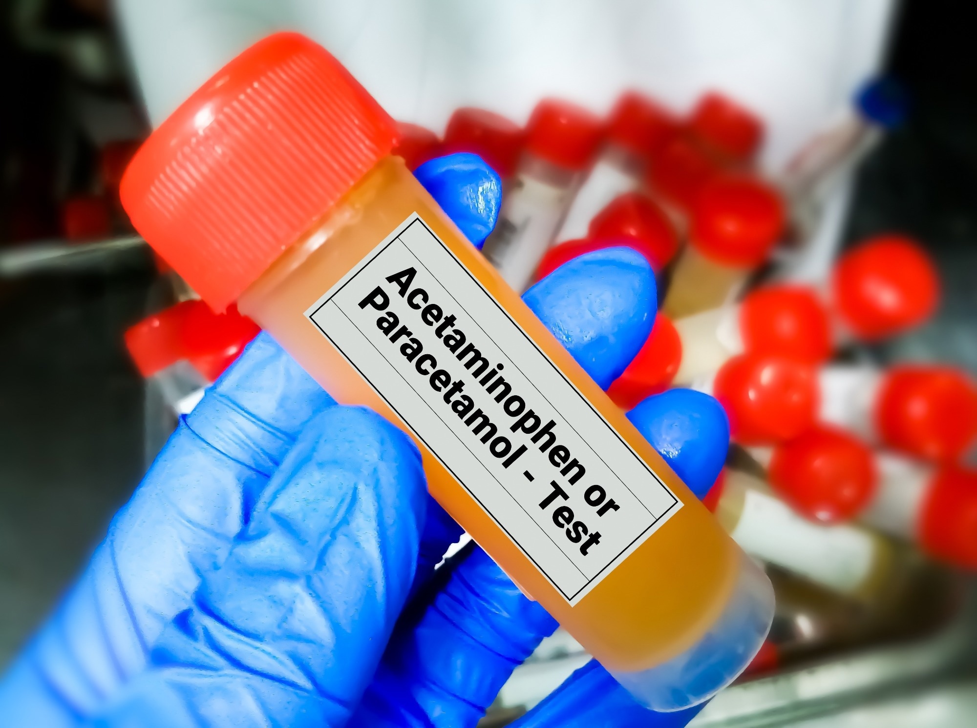 New Nanodiamond Sensor for Paracetamol Detection