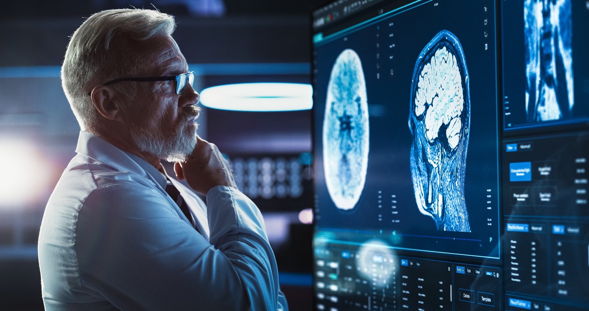 AI Drives Optical Sensors for Brain Monitoring