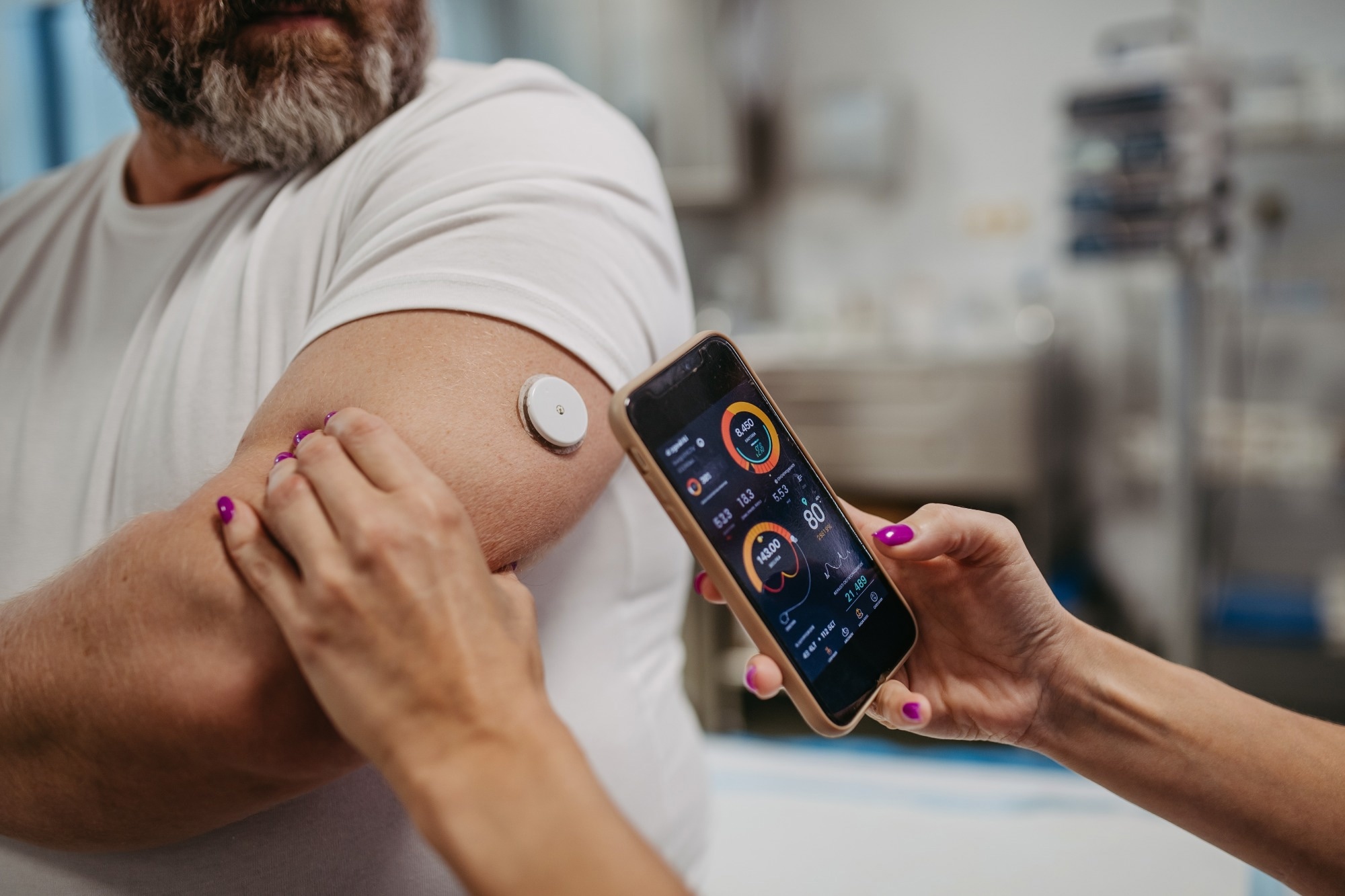 Doctor connecting continuous glucose monitor with smartphone, to check blood sugar level in real time.