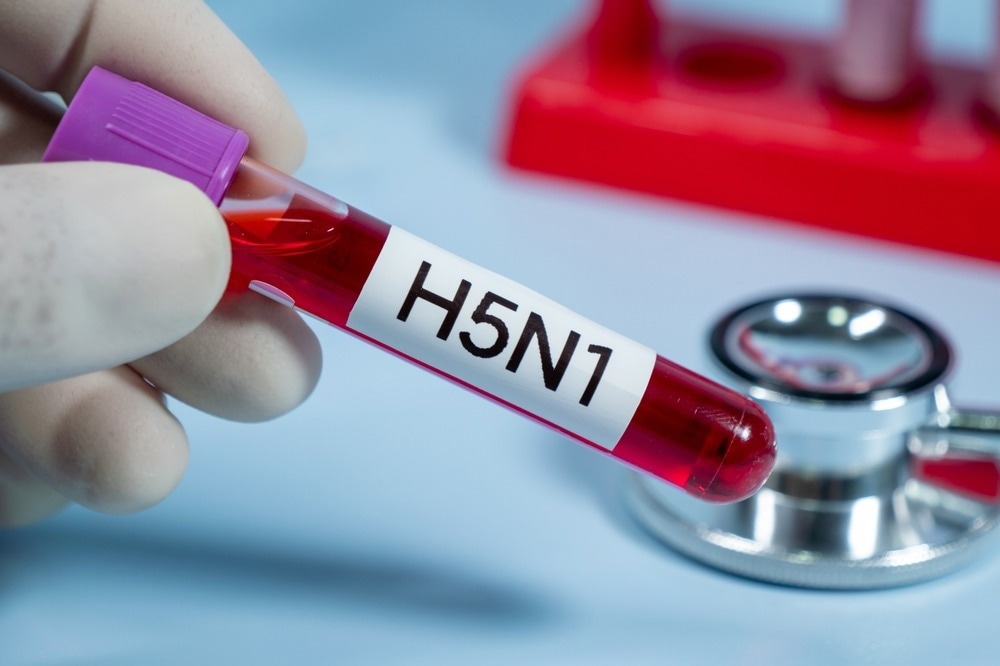 bird flu sensor