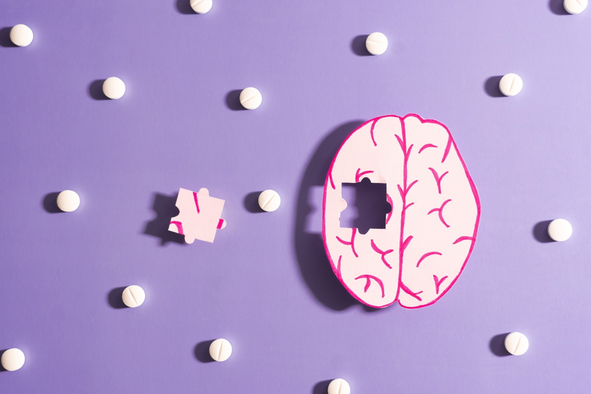 Treatment of Alzheimer
